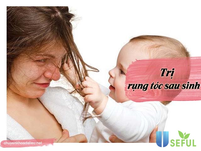 20 cách trị rụng tóc sau sinh an toàn kích thích mọc dày đẹp tự nhiên 20 cách trị rụng tóc sau sinh an toàn kích thích mọc dày đẹp tự nhiên